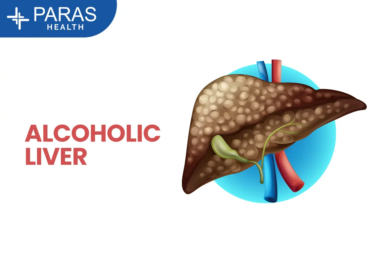 How Alcohol Affects Your Liver